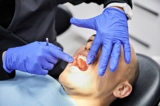 Best Emergency Dentist for Lost Fillings or Crowns in Dent, OH